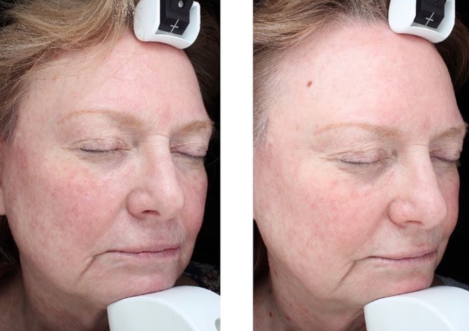 a person with her eyes closed