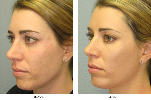 Before and after of face
